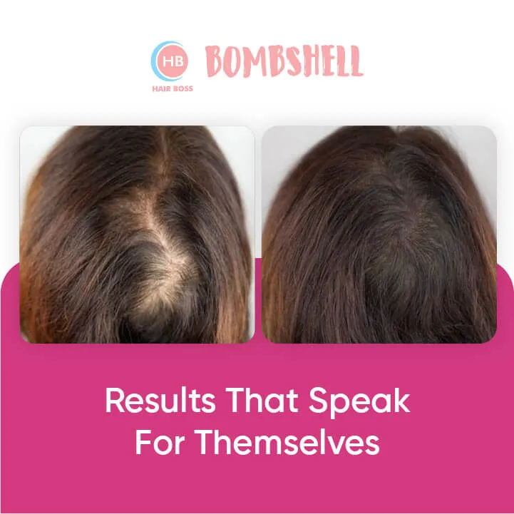 Bombshell Hair Growth Spray: For Men & Women